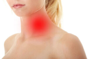 Лечение лимфомы Ходжкина в Израиле