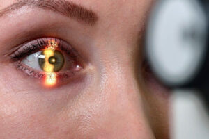 Лечение рака глаза в Израиле