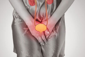 Лечение рака уретры в Израиле