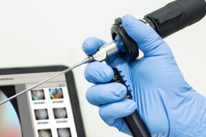 уретроскопия