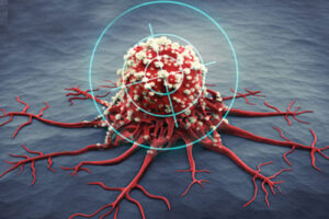 Таргетная терапия