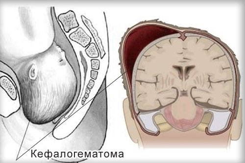 Хирург - Вопросы специалисту | Детский Клинико Диагностический центр в Домодедово