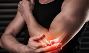 Найден белок, отвечающий за боль в сухожилиях